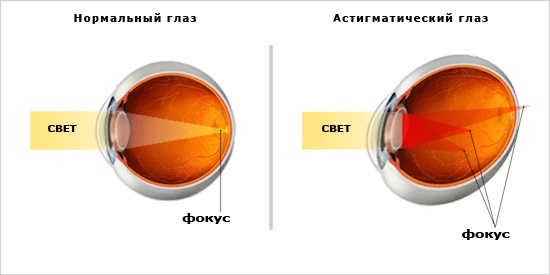 Профессор жданов восстановление зрения метод бейтса